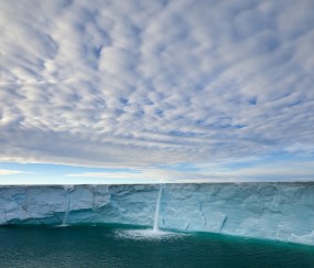 怀孕初期老淌虚汗是怎么回事